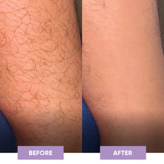 Glow Glide Crystal Epilator